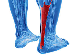 Achilles Tendonitis Treatment in the Macomb County, MI: Washington Twp. (Romeo, Almont, Oakland Charter Township, Addison Township, Armada, Lenox, Ray, Lakeville, Leonard, New Haven) and Shelby Twp. (Rochester, Utica, Chesterfield, Sterling Heights, Fraser, Clinton Twp, Mt Clemens, Harrison Twp, Warren, New Baltimore) areas