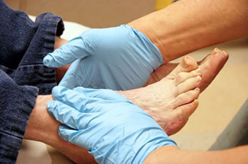 Diabetic foot care in the Macomb County, MI: Washington Twp. (Romeo, Almont, Oakland Charter Township, Addison Township, Armada, Lenox, Ray, Lakeville, Leonard, New Haven) and Shelby Twp. (Rochester, Utica, Chesterfield, Sterling Heights, Fraser, Clinton Twp, Mt Clemens, Harrison Twp, Warren, New Baltimore) areas