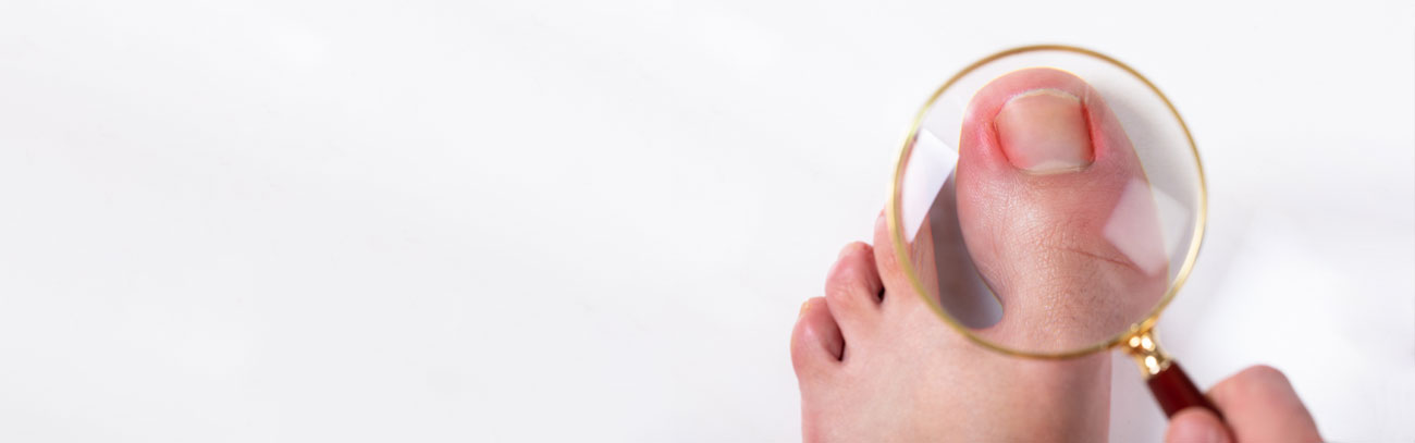 Ingrown Toenail Treatment in the Washington Twp., MI 48095 and Shelby Twp., MI 48315 areas