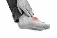 A Brief History of Gout