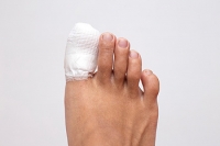 Possible Treatment of a Broken Toe