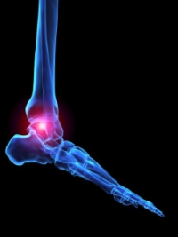 Warning Signs for Rheumatoid Arthritis